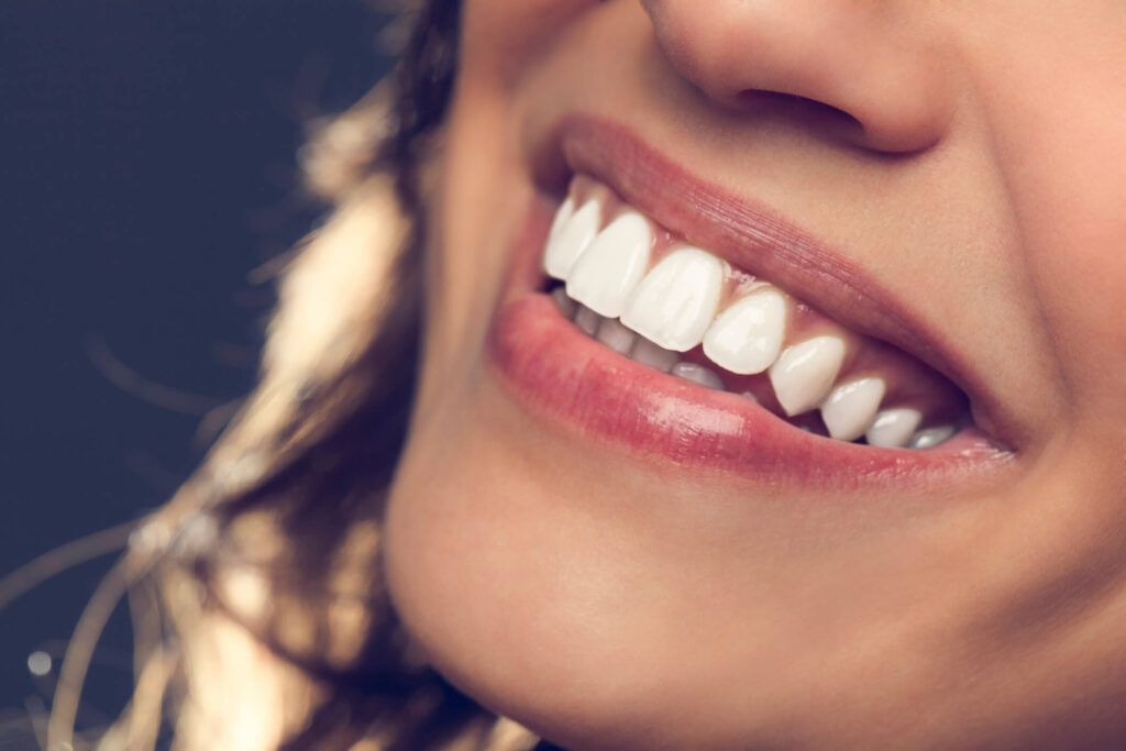 Como Ter Um Sorriso Perfeito Veja 7 Dicas Para Arrasar Odontocompany